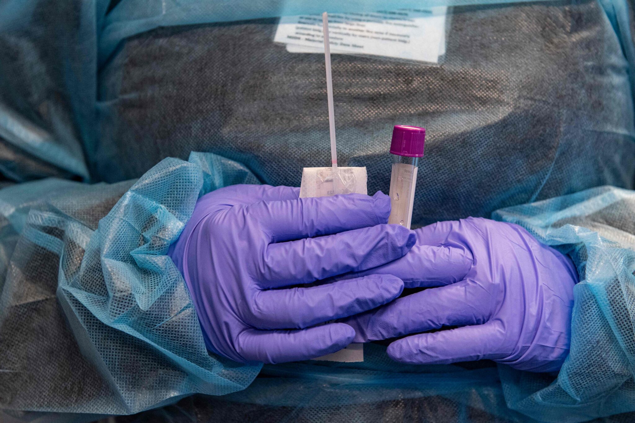 A medical worker prepares a Covid-19 PCR test at East Boston Neighborhood Health Center in Boston, Massachusetts on December 20, 2021. Boston Mayor Michelle Wu announced that starting January 15, 2022, guest and employees, in the Boston will be required to show proof of vaccination against Covid-19 in order to enter some indoor spaces, including dining venues, bars and nightclubs, fitness centers and any indoor entertainment venues. The new city mandate also requires all city employees to be vaccinated with at least one dose by January 15, and two doses by February 15. (Photo by Joseph Prezioso / AFP)