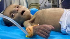 Palestinian toddler Leila Jeneid, who suffers from severe malnutrition, receives treatment at Kamal Adwan Hospital, amid the ongoing conflict between Israel and Hamas in Gaza where lack of food and essential nutrients has been a collective struggle in the enclave, in the northern Gaza Strip, March 26, 2024. REUTERS/Osama Abu Rabee