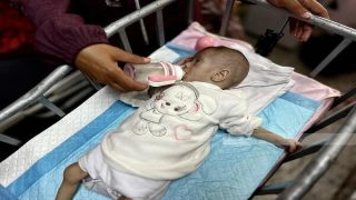 “الأونروا”: طفلا من كل 10 أطفال بغزة يخضعون للفحص يعاني من سوء التغذية