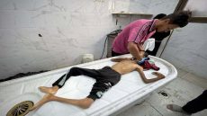 5 وفيات نتيجة المجاعة وسوء التغذية خلال الـ24 ساعة الماضية