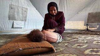 وفاة 4 مواطنين خلال الـ24 ساعة الماضية بسبب سوء التغذية والمجاعة في قطاع غزة