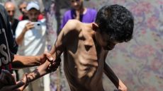 وفيات جديدة جراء التجويع في غزة ترفع الحصيلة إلى 162.. معظمهم أطفال