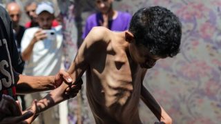 وفيات جديدة جراء التجويع في غزة ترفع الحصيلة إلى 162.. معظمهم أطفال