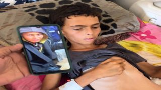 خمسة ضحايا جدد نتيجة الجوع في قطاع غزة يرفع الحصيلة إلى 162