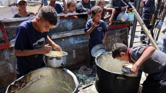صحة غزة: 28 ألف حالة سوء تغذية والمجاعة وصمة عار على جبين الأمم المتحدة