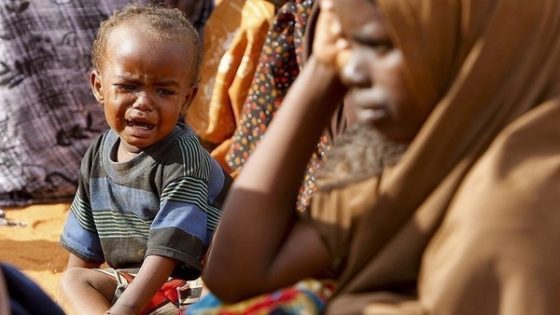 الأمم المتحدة: السودان أمام أكبر أزمة جوع في العالم والكوليرا تتفشى