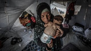 اليونيسيف: طفل من كل 5 في غزة يولد مبكرا أو ناقص وزن بسبب المجاعة